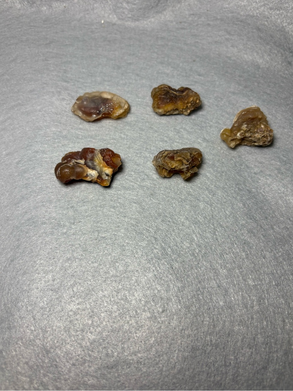 Lot of 5 Wa State Botryoidal Chalcedony/ Nodules Eyes/Agate Rough Specimens